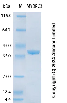 SDS-PAGE - Recombinant Human MYBPC3 Protein Standard (His tag) (AB323111)