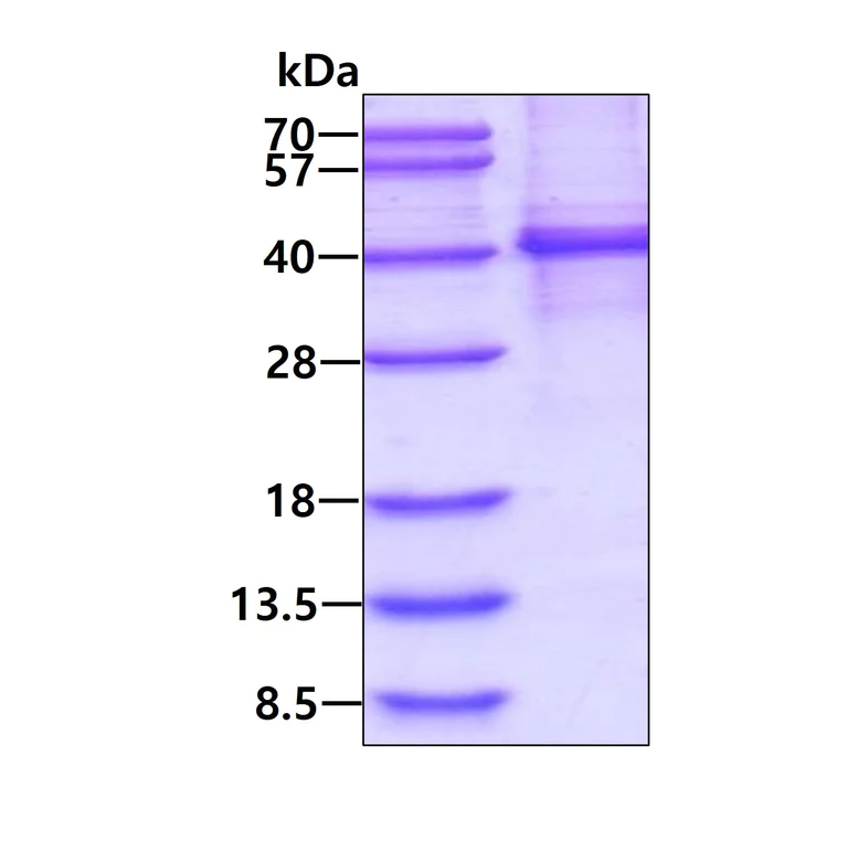 SDS-PAGE - Recombinant Human MyD88 protein (denatured) (His tag N-Terminus) (AB139225)