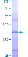 SDS-PAGE - Recombinant Human MyD88 protein (GST tag N-Terminus) (AB114217)