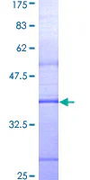 SDS-PAGE - Recombinant Human MyD88 protein (GST tag N-Terminus) (AB114217)