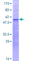 SDS-PAGE - Recombinant Human Myelin Protein Zero (GST tag N-Terminus) (AB114281)