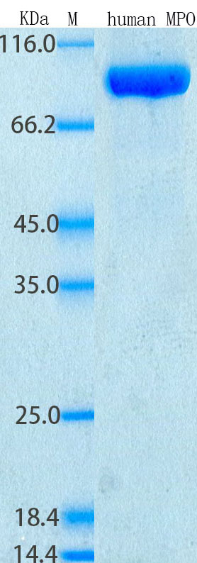 SDS-PAGE - Recombinant Human Myeloperoxidase Protein Standard (His tag) (AB316416), expandable thumbnail