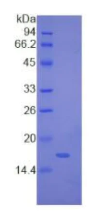 SDS-PAGE - Recombinant Human MYL1 protein (His tag) (AB275566)