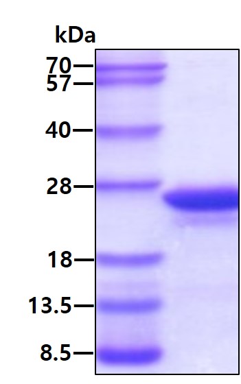 SDS-PAGE - Recombinant Human MYL12A protein (His tag N-Terminus) (AB113139)