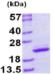 SDS-PAGE - Recombinant Human MYL12B protein (AB128438), expandable thumbnail