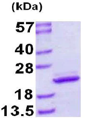 SDS-PAGE - Recombinant Human MYL12B protein (His tag N-Terminus) (AB128438)