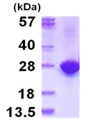 SDS-PAGE - Recombinant Human MYL4 protein (AB115722)