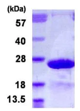 SDS-PAGE - Recombinant Human MYL7 protein (AB126669)
