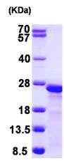 SDS-PAGE - Recombinant Human MYL9 protein (His tag N-Terminus) (AB104014)