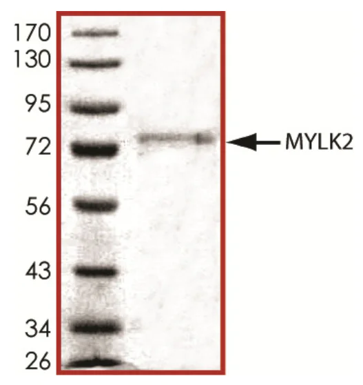SDS-PAGE - Recombinant human MYLK2 protein (AB84800)