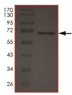 SDS-PAGE - Recombinant human MYLK4 protein (AB190995), expandable thumbnail
