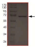 SDS-PAGE - Recombinant human MYLK4 protein (AB190995)