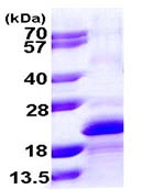 Recombinant Human MYLPF protein