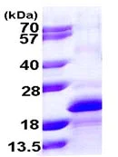 SDS-PAGE - Recombinant Human MYLPF protein (His tag N-Terminus) (AB109842)