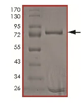 SDS-PAGE - Recombinant human MYO3A protein (AB191000)