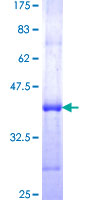 SDS-PAGE - Recombinant Human Myoferlin protein (GST tag N-Terminus) (AB161989)