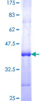 SDS-PAGE - Recombinant Human Myoferlin protein (GST tag N-Terminus) (AB161989)
