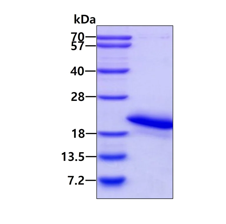 SDS-PAGE - Recombinant Human Myoglobin protein (His tag N-Terminus) (AB103505)