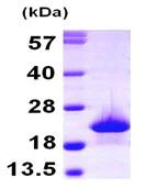 SDS-PAGE - Recombinant Human Myoglobin protein (His tag N-Terminus) (AB103505)