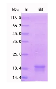 SDS-PAGE - Recombinant Human Myoglobin Protein Standard (His tag) (AB316414)