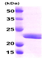 SDS-PAGE - Recombinant Human Myosin Light Chain 2 protein (AB79185), expandable thumbnail