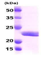 SDS-PAGE - Recombinant Human Myosin Light Chain 2 protein (His tag N-Terminus) (AB79185)