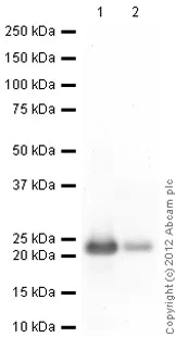 Western blot - Recombinant Human Myosin Light Chain 2 protein (His tag N-Terminus) (AB79185)