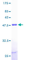 SDS-PAGE - Recombinant Human Myosin light chain 3 protein (GST tag N-Terminus) (AB158937)