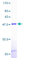 SDS-PAGE - Recombinant Human Myosin light chain 3 protein (GST tag N-Terminus) (AB158937)