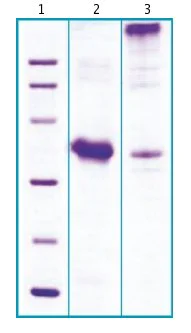 SDS-PAGE - Recombinant Human Myostatin Propeptide protein (AB63300)