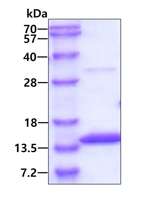 SDS-PAGE - Recombinant Human Myotrophin protein (His tag N-Terminus) (AB101086)
