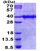 SDS-PAGE - Recombinant Human Myozenin 1 protein (denatured) (AB168067), expandable thumbnail
