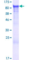 Recombinant Human N-ethylmaleimide-sensitive fusion protein
