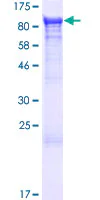 SDS-PAGE - Recombinant Human N-ethylmaleimide-sensitive fusion protein (GST tag N-Terminus) (AB132100)