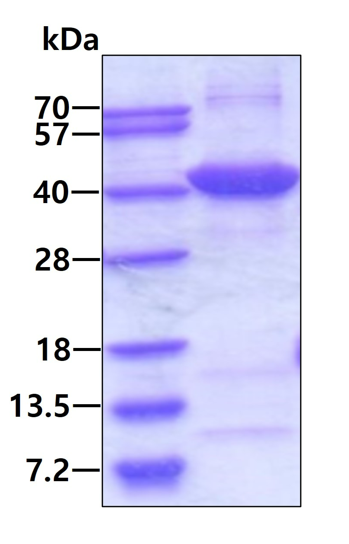 SDS-PAGE - Recombinant Human N myc interactor/NMI protein (His tag N-Terminus) (AB103504)