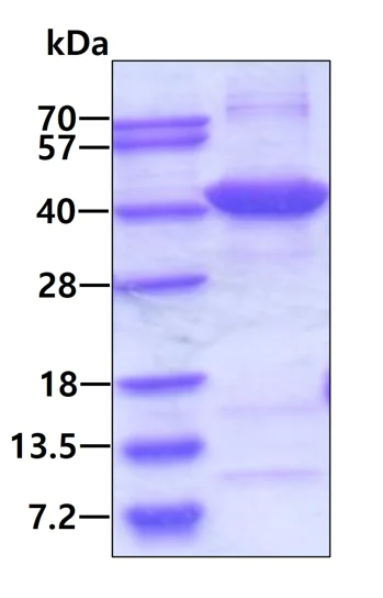 SDS-PAGE - Recombinant Human N myc interactor/NMI protein (His tag N-Terminus) (AB103504)