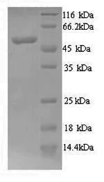 SDS-PAGE - Recombinant Human n-Myc/MYCN protein (His tag) (AB241520)