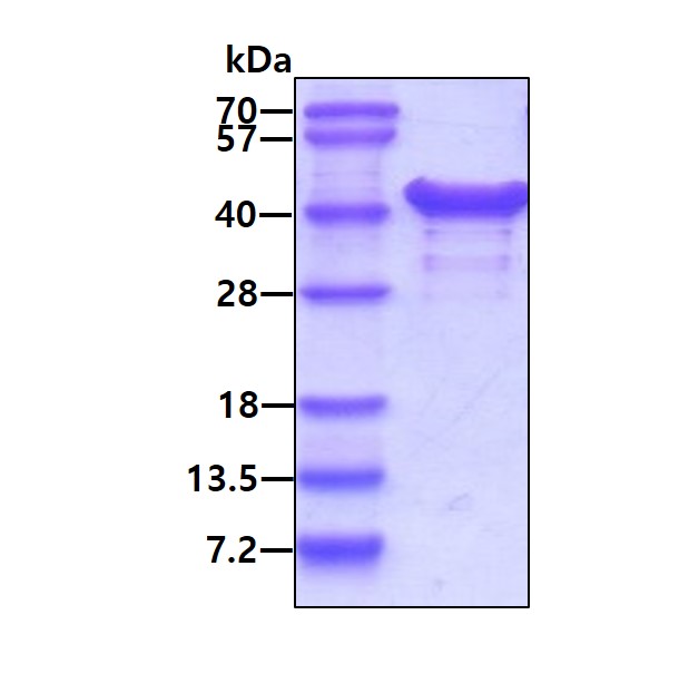 SDS-PAGE - Recombinant Human NACA1 protein (AB113865)