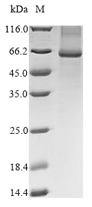 SDS-PAGE - Recombinant Human NADPH oxidase 4 protein (AB289740)