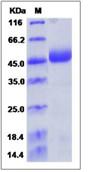 SDS-PAGE - Recombinant Human NAGA protein (His tag) (AB276577)