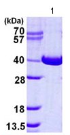 SDS-PAGE - Recombinant Human NAGK protein (His tag N-Terminus) (AB124563)