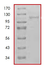 SDS-PAGE - Recombinant human NAK/TBK1 protein (AB85276), expandable thumbnail