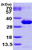 SDS-PAGE - Recombinant Human NANP protein (His tag N-Terminus) (AB99392)