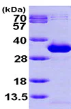 SDS-PAGE - Recombinant Human NANP protein (AB99392)