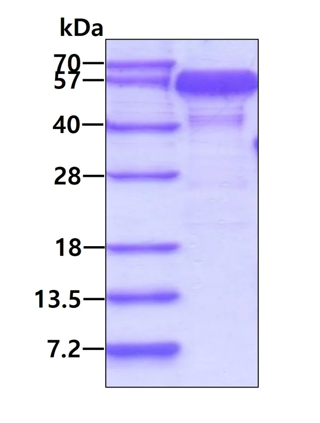 SDS-PAGE - Recombinant Human NAP1L1 protein (AB117213)