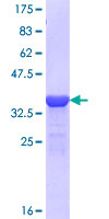 SDS-PAGE - Recombinant Human NARG1 protein (AB164208), expandable thumbnail