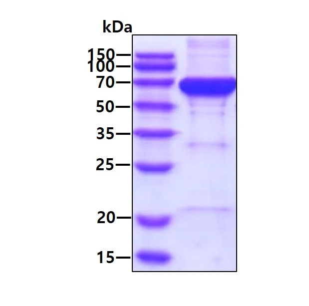 SDS-PAGE - Recombinant Human NARS protein (AB207154)