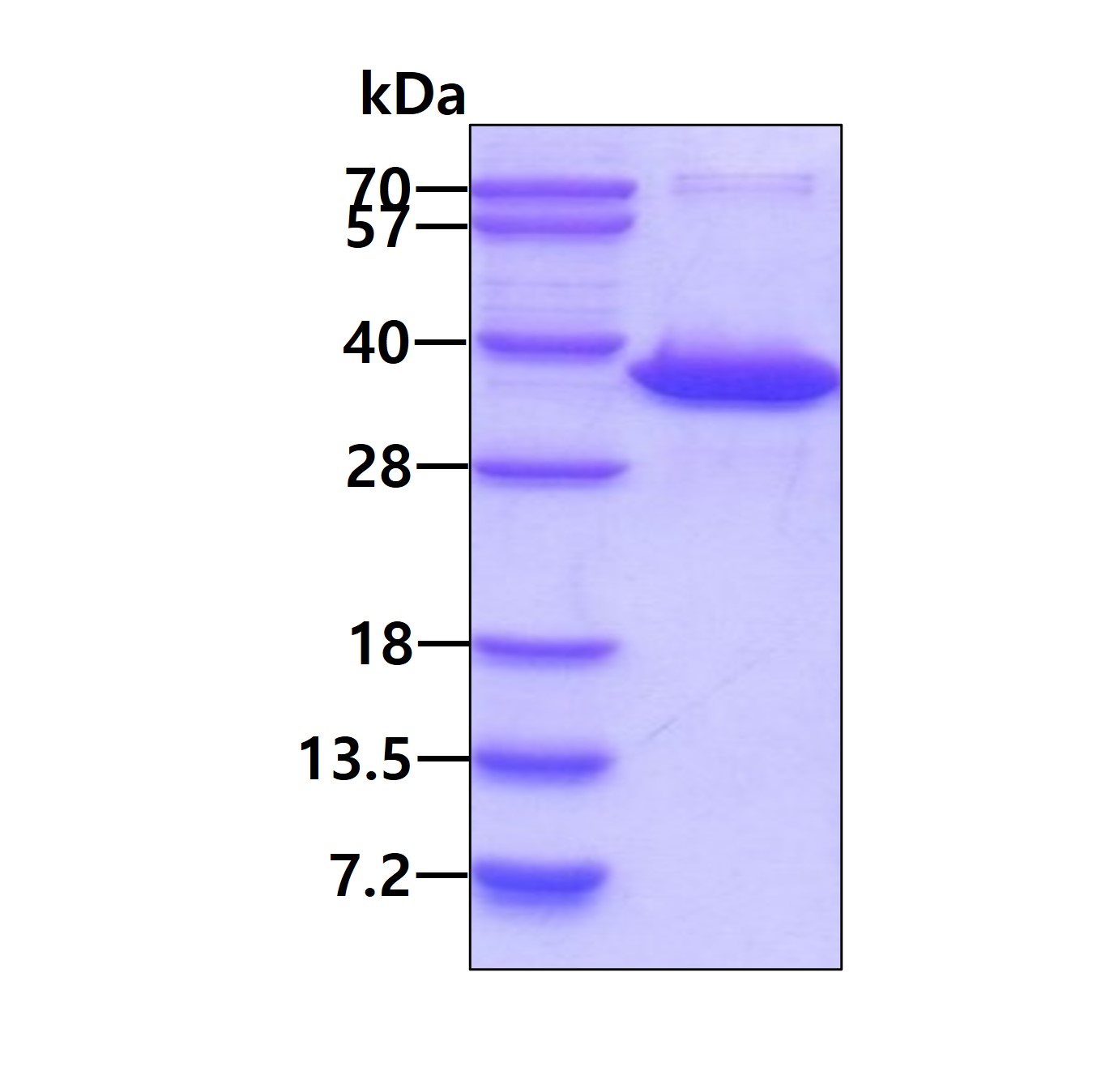 SDS-PAGE - Recombinant Human NAT1 protein (His tag N-Terminus) (AB109846)