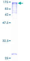 SDS-PAGE - Recombinant Human NAT10 protein (AB163025)
