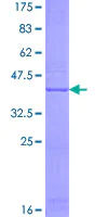 SDS-PAGE - Recombinant Human NAT8L protein (AB166273)
